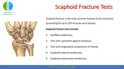 scaphoid fracture compression test|scaphoid fracture prognosis.